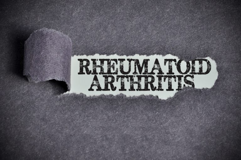 What is Rheumatoid Arthritis?